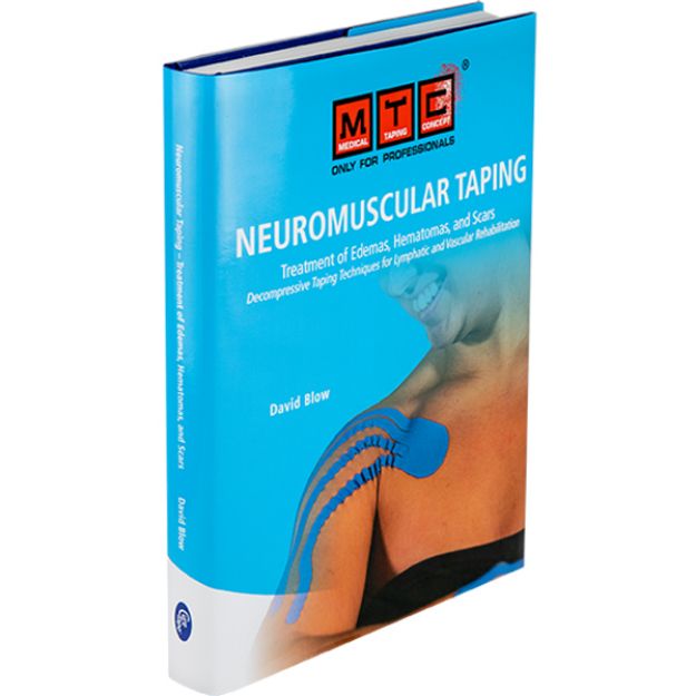 Afbeeldingen van NMT Taping bij oedeem, hematomen en littekens