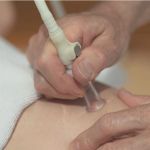 Afbeeldingen van Vacuodermie TV6K