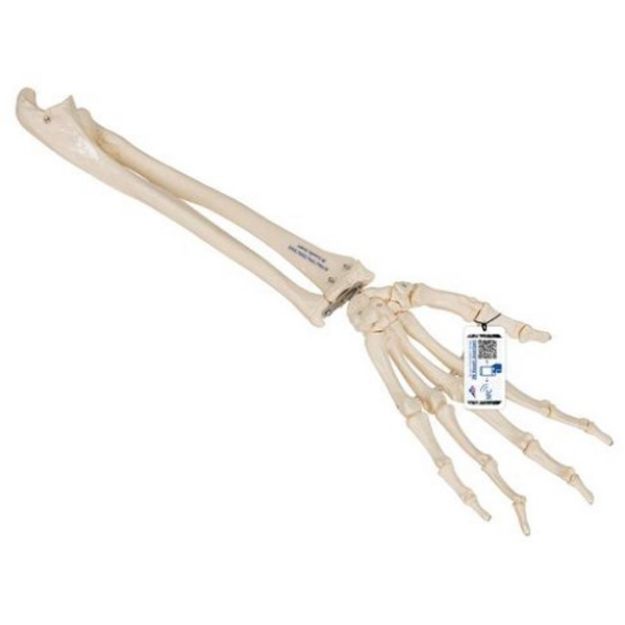 Afbeeldingen van Hand met ulna & radius